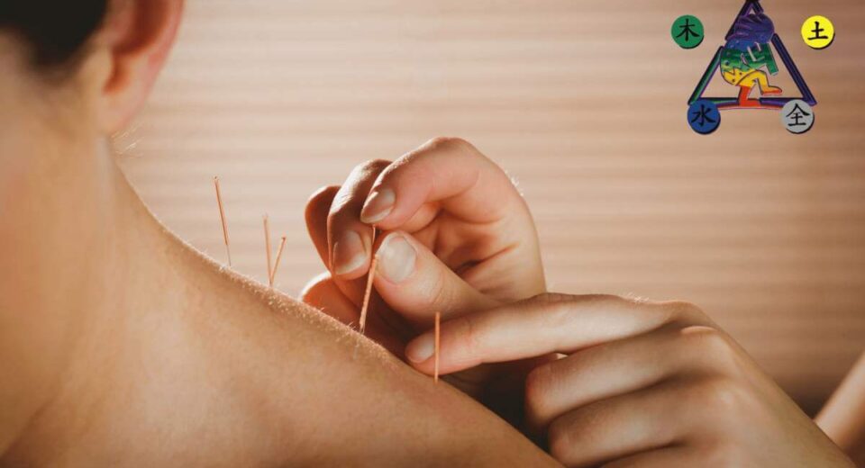Acupuncture for the Masses, and 2 Best Types of “Do It Yourself” Acupuncture Products