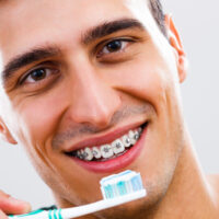 Best Toothpaste For Braces: 3 Great Options for a Sensitive Situation
