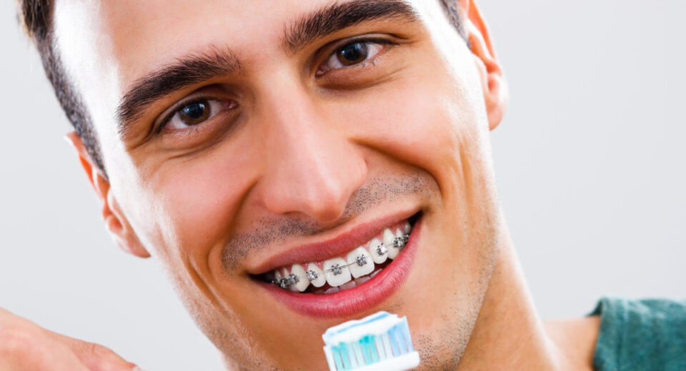 Best Toothpaste For Braces: 3 Great Options for a Sensitive Situation