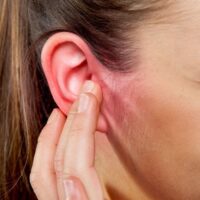 Psoriasis Ear – How to treat it with natural remedies