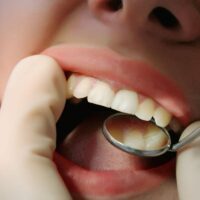 Can Gum Disease Be Cured? The Natural Treatment That Most Dentists Don’t Mention TheWellthieone