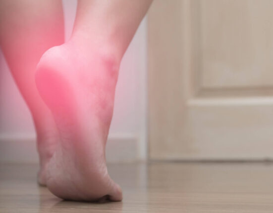 How to Cure Plantar Fasciitis in One Week TheWellthieone