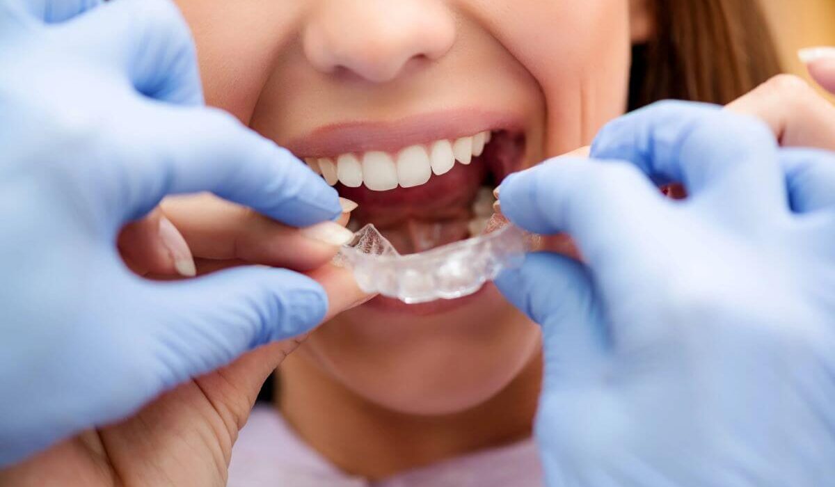 How To Clean Invisalign Retainers – Avoid That Cloudy Film!