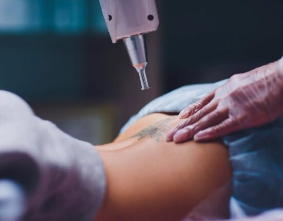 Does Tattoo Removal Leave Scars? All You Need To Know! TheWellthieone