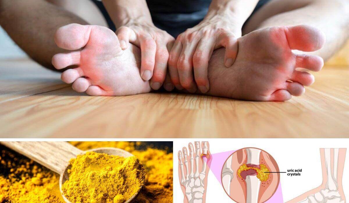 If You Have Gout, Try Turmeric for Powerful Inflammation & Pain Relief! TheWellthieone