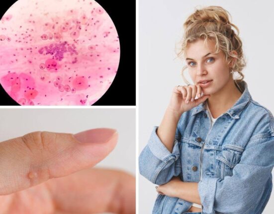 Zap ‘Em With The 3 Best Essential Oils For Warts! Thewellthieone