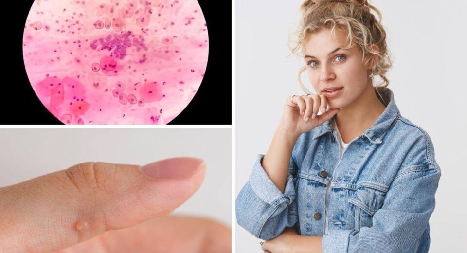 Zap ‘Em With The 3 Best Essential Oils For Warts! Thewellthieone