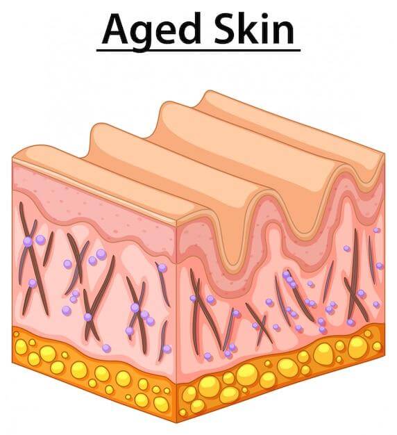 Collagen production in skin decreases as we age, and a crepey texture is commonly found on arms, legs and even the face. 