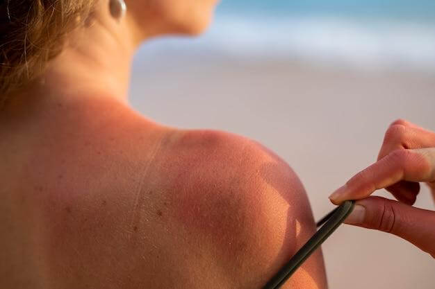 Wear a thin shirt cover after 20 minutes in the sun if you are prone to burning.