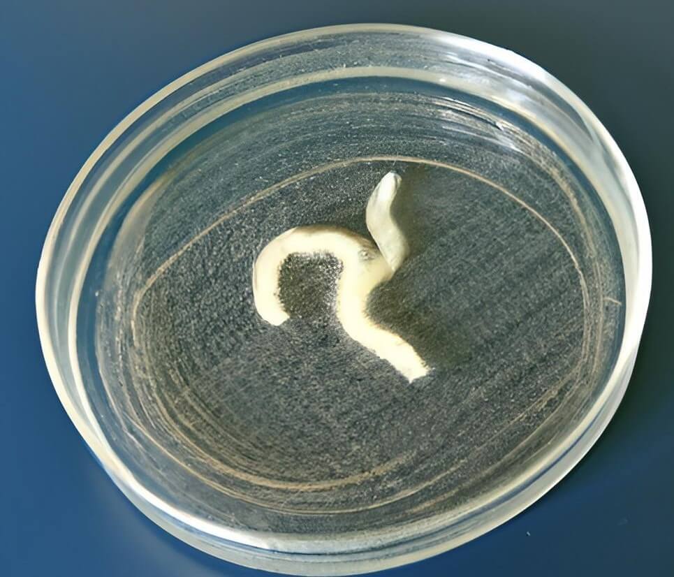 Tapeworms are white and flat, and can grow very long in the body, some presenting like a tumor as they grow.