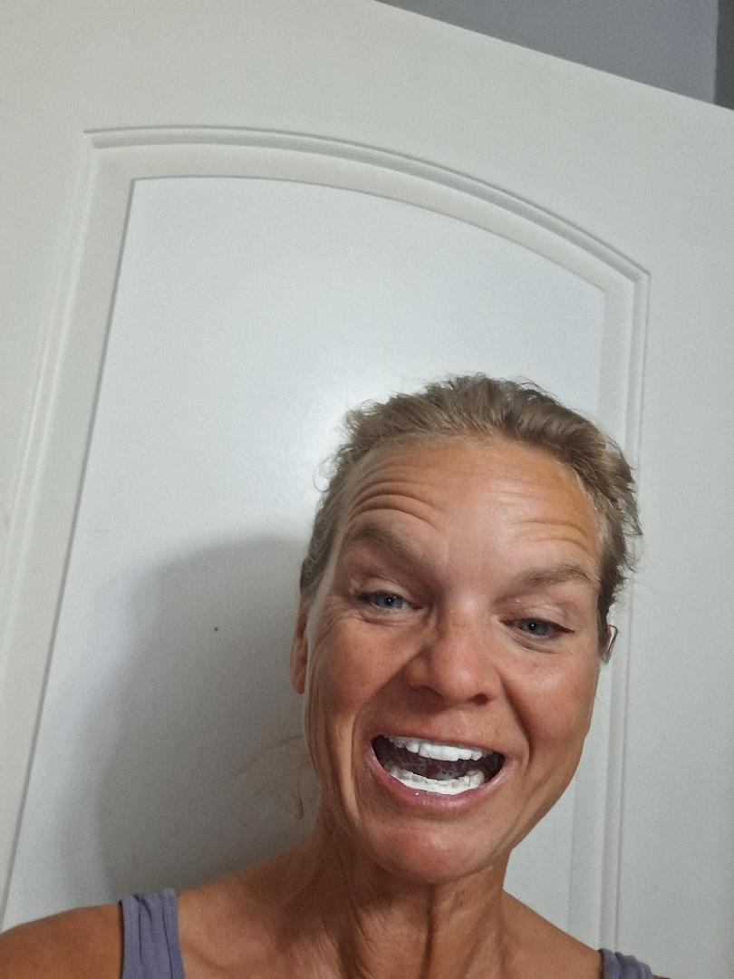 Close up of teeth coated in wet pearl powder after taking a half teaspoon, showing how the powder oozes unevenly around the mouth while the minerals absorb into enamel