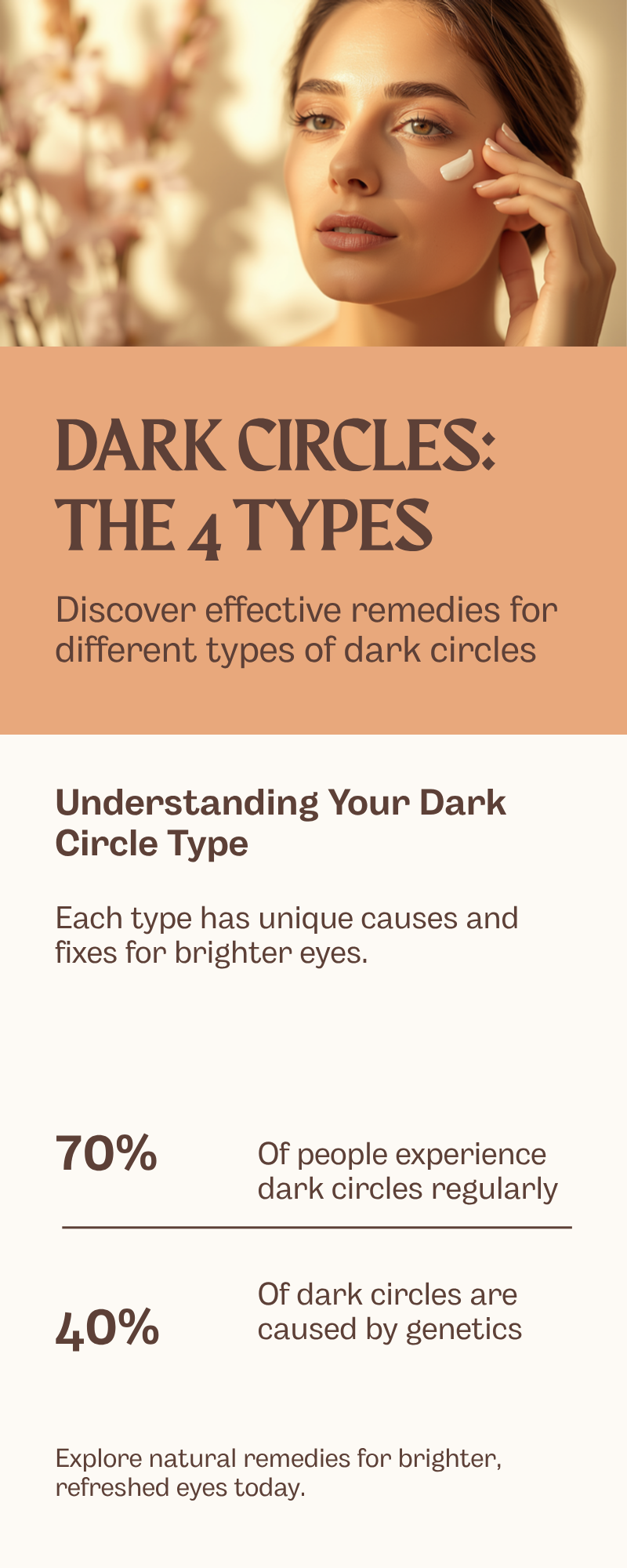 Dark circles 4 types infographic showing blue veins, brown pigment, hollow shadow, and puffy bag patterns with the right fix for each