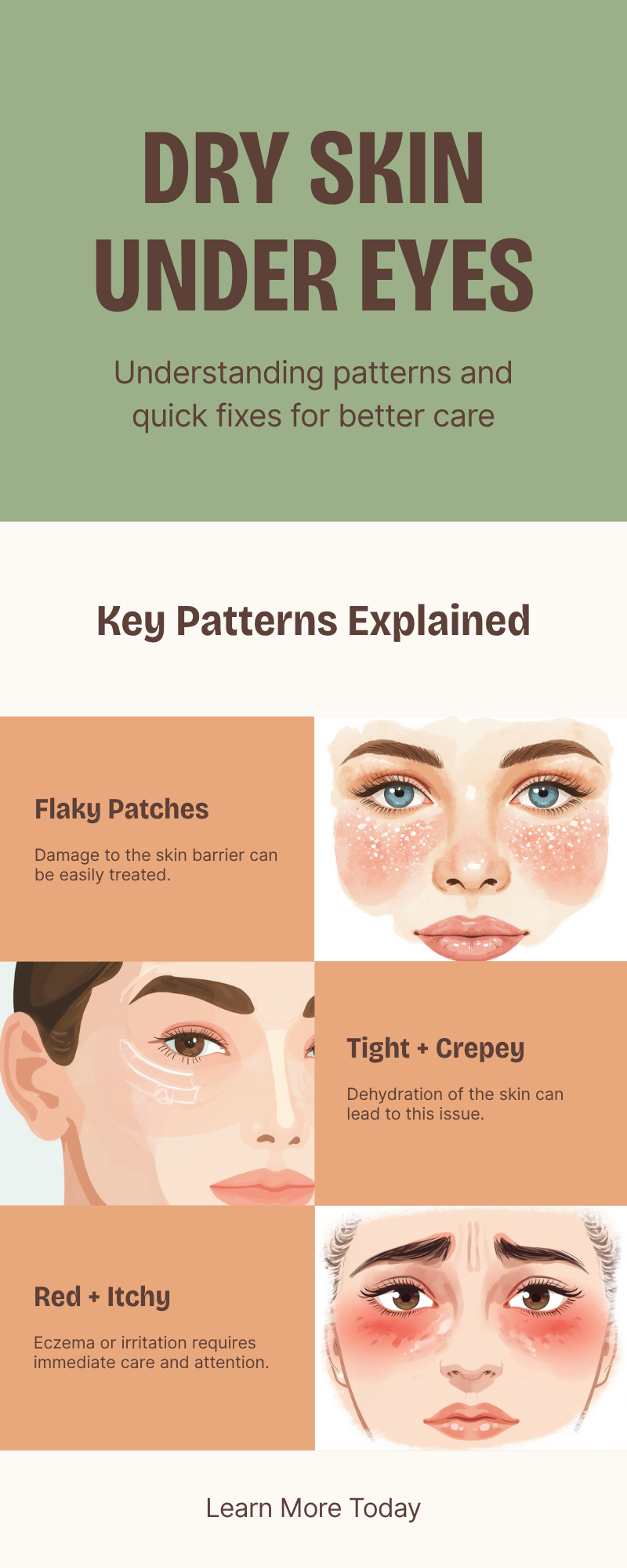 Dry skin under eyes 4 patterns infographic showing flaky, tight, red, and dull types