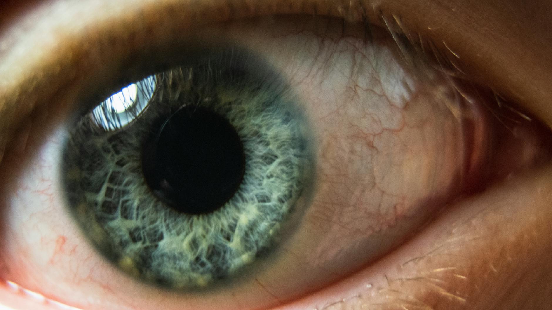 Close-up of human eye showing sclera color for liver health