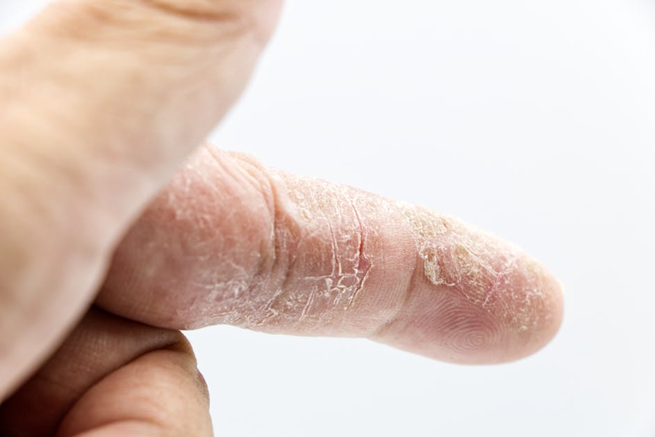 athlete's foot vs dry skin closeup comparison
