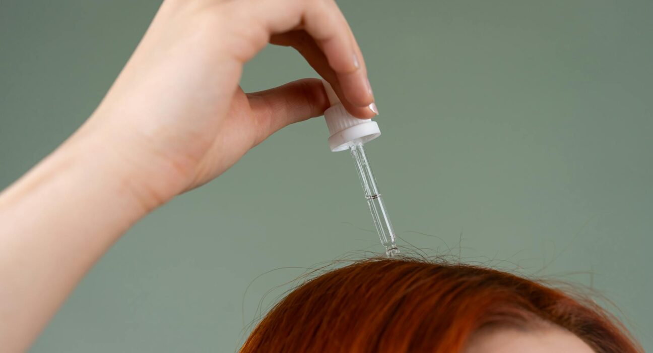can dandruff cause hair thinning