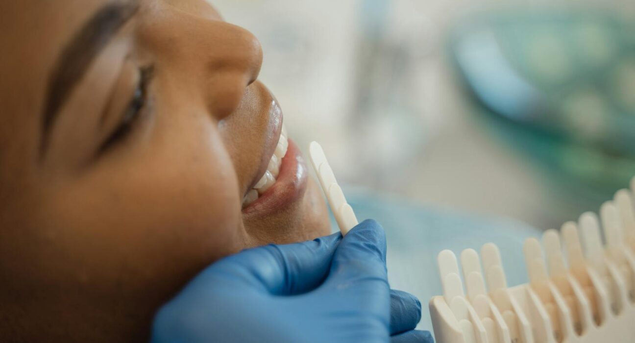 Smiling woman in dental chair holding a tooth shade guide to plan teeth whitening
