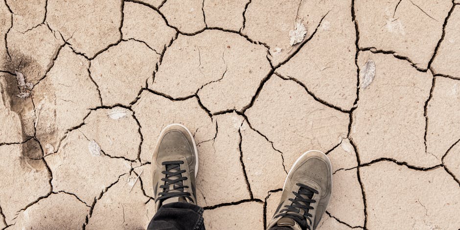 white dry skin on feet showing cracked heels closeup
